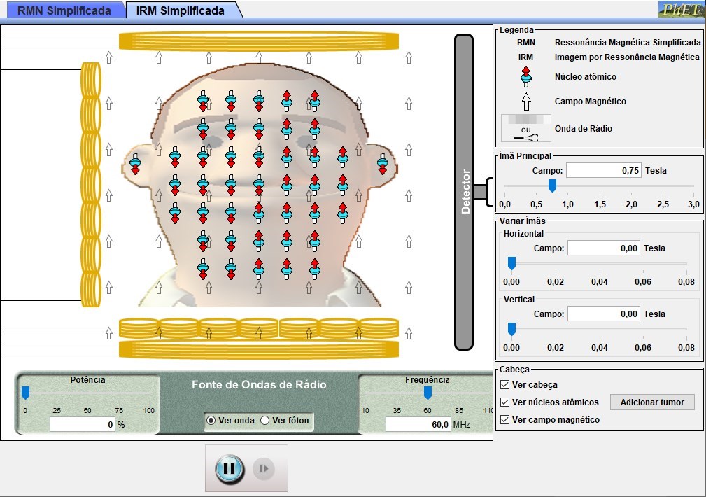 Diagnstico por Imagem de Ressonncia Magntica: Investigando Tumores